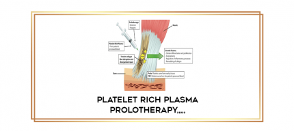 Platelet Rich Plasma Prolotherapy from https://imylab.info